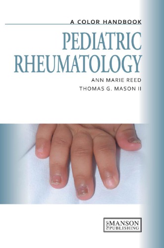 Pediatric Rheumatology