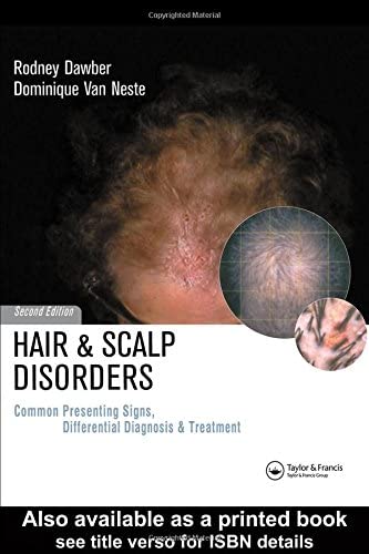 Hair and Scalp Disorders