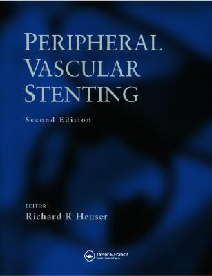 Peripheral Vascular Stenting