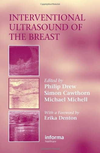 Interventional Ultrasound of the Breast