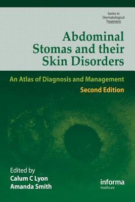 Abdominal Stomas and Their Skin Disorders