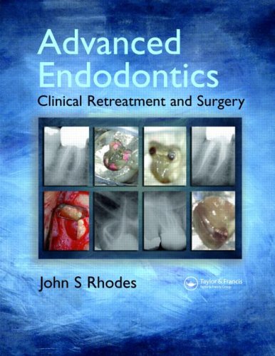 Advanced Endodontics