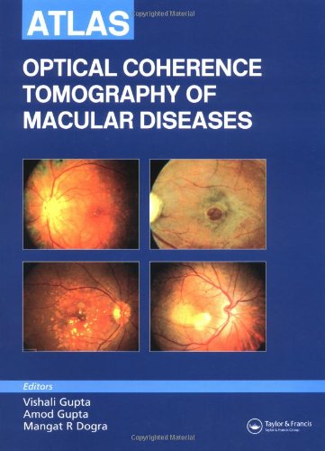 Atlas Optical Coherence Tomography Of Macular Diseases