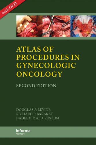 Atlas of Procedures in Gynecologic Oncology [With DVD]