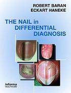 Nail In Differential Diagnosis