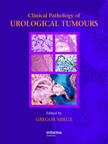 Clinical Pathology Of Urological Tumours