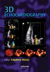 3D Echocardiography