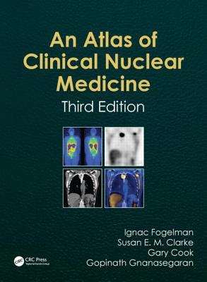 Atlas Of Clinical Nuclear Medicine