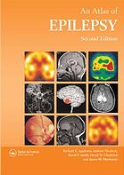 Atlas of Epilepsy, Second Edition (ENCYCLOPEDIA OF VISUAL MEDICINE SERIES)