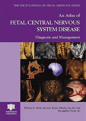 An Atlas of Fetal Central Nervous System Disease