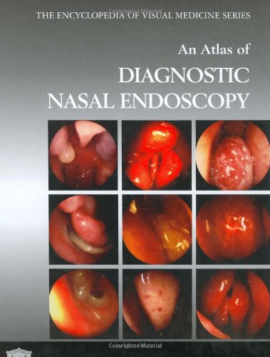 An Atlas Of Diagnostic Nasal Endoscopy (Encyclopedia Of Visual Medicine Series)