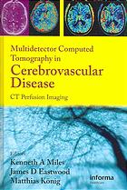 Multidetector Computed Tomography In Cerebrovascular Disease