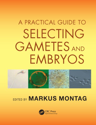 A Practical Guide to Selecting Gametes and Embryos