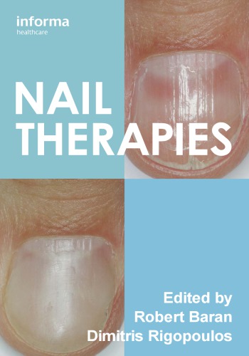 Nail Therapies