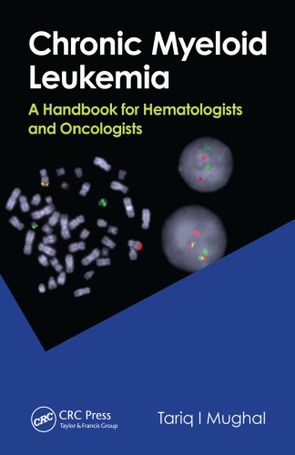 Clinical Pocket Guide to CML