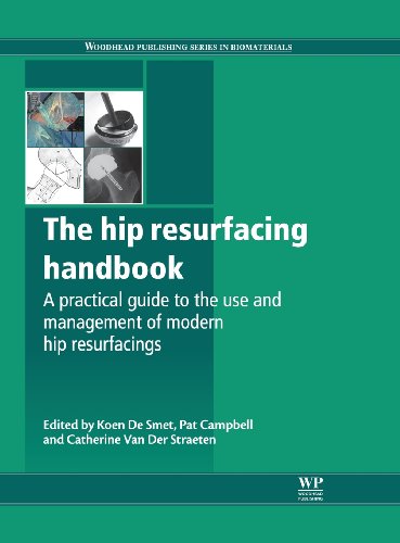 The hip resurfacing handbook