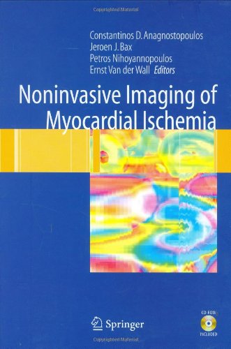 Noninvasive Imaging of Myocardial Ischemia