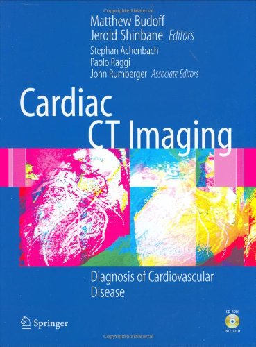 Cardiac CT Imaging