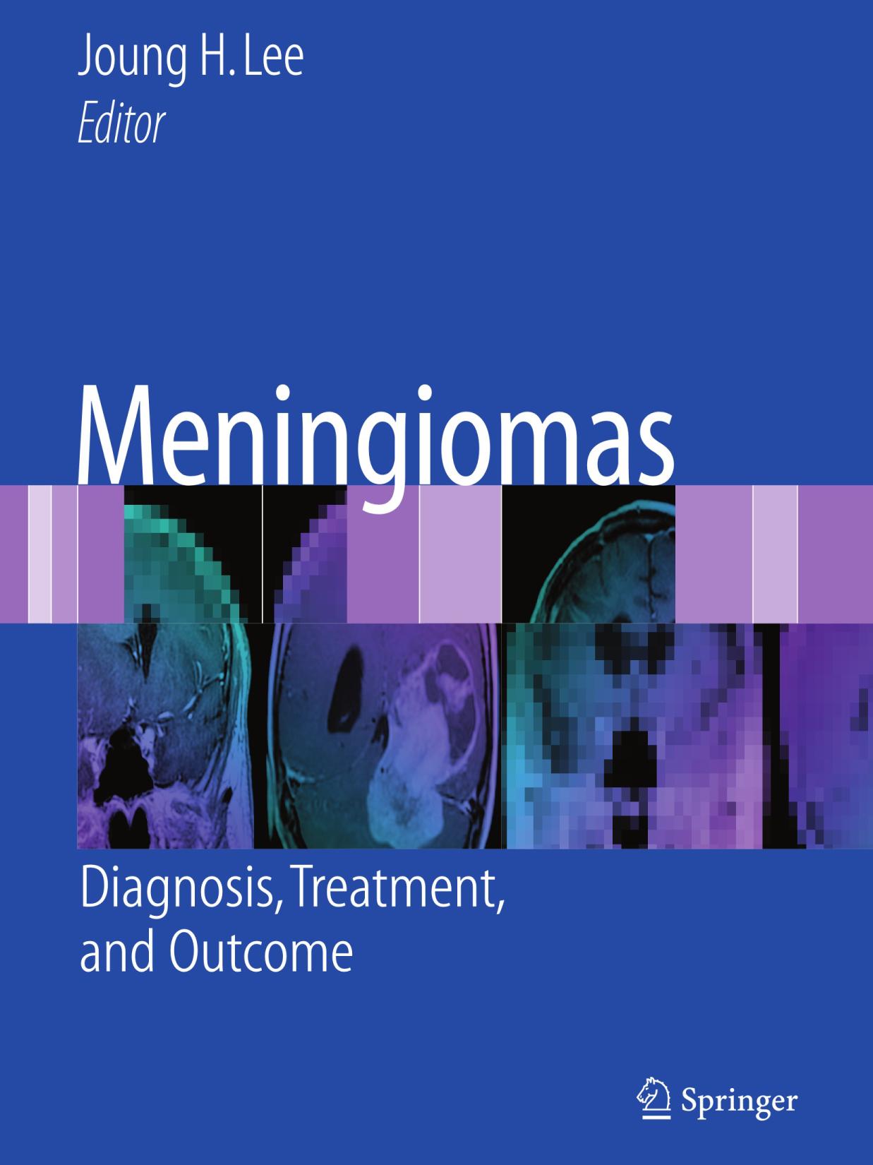 Meningiomas