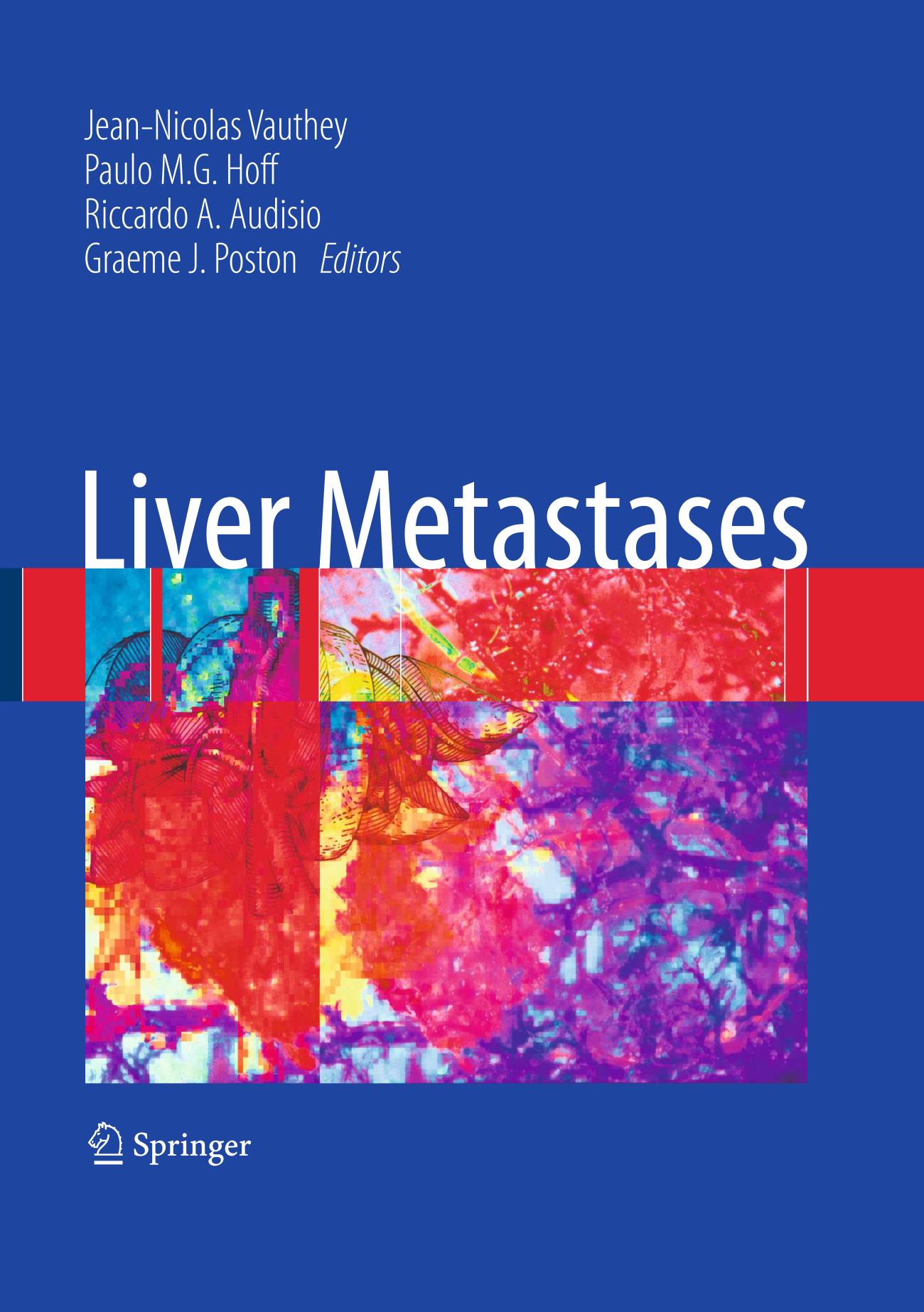 Liver Metastases