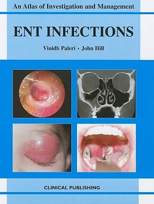 Ent Infections