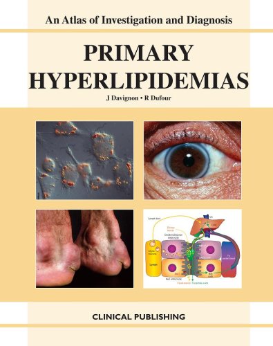 Primary Hyperlipidemias.