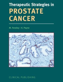 Therapeutic Strategies in Prostate Cancer