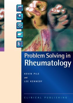 Problem Solving in Rheumatology.