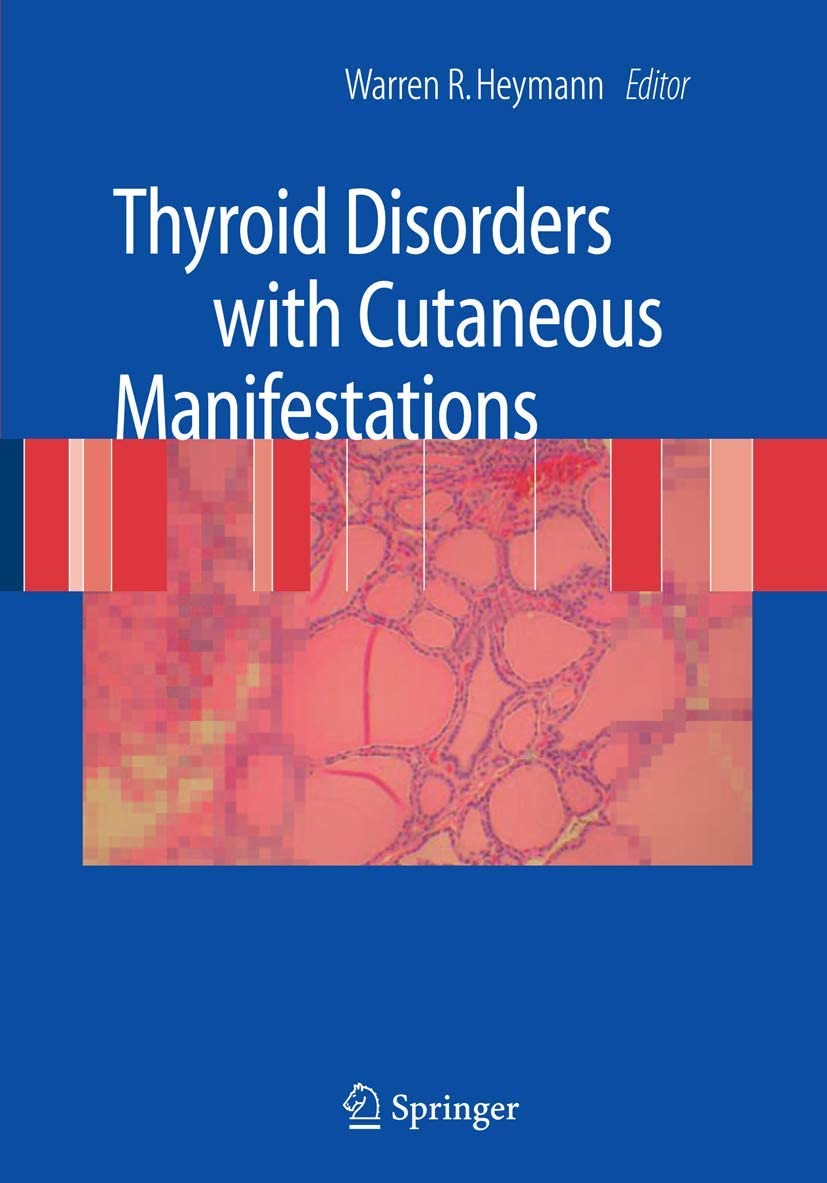 Thyroid Disorders With Cutaneous Manifestations