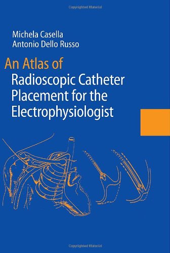 An Atlas of Radioscopic Catheter Placement for the Electrophysiologist