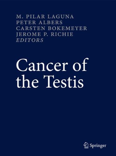 Cancer of the Testis