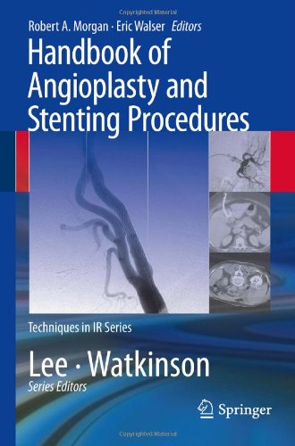 Handbook of Angioplasty and Stenting Procedures