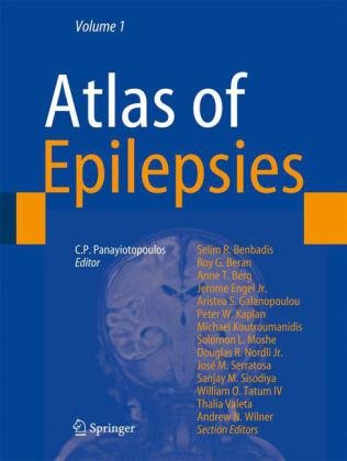 Atlas Of Epilepsies