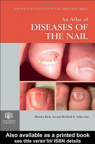 An Atlas of Diseases of the Nail