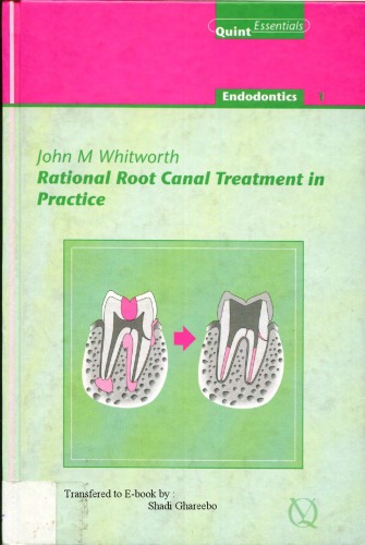 Rational Root Canal Treatment in Practice