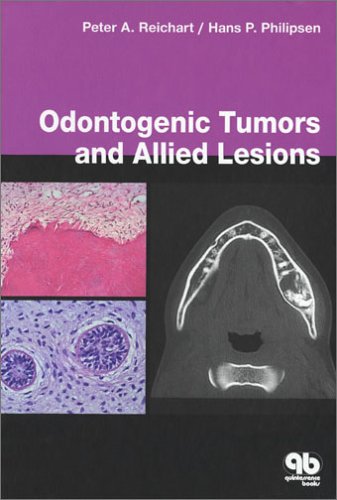 Odontogenic Tumors and Allied Lesions