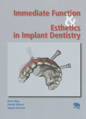 Immediate Function &amp; Esthetics in Implant Dentistry