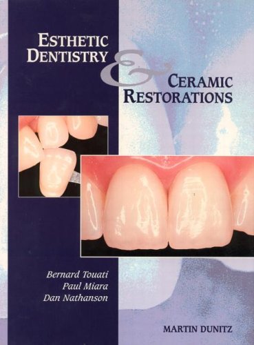 Esthetic Dentistry and Ceramic Restoration