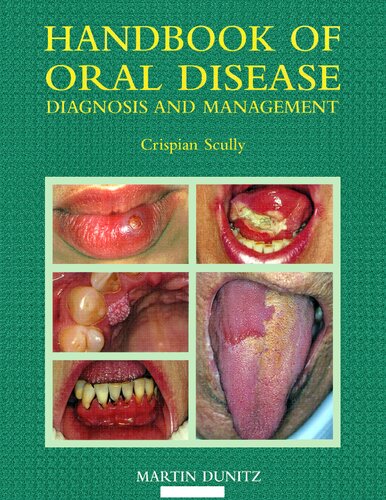 Handbook of Oral Disease