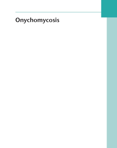 Onychomycosis