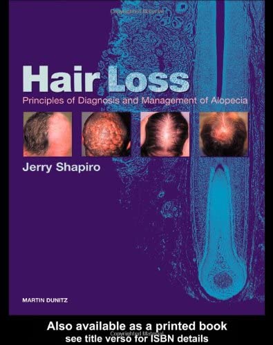 Hair Loss