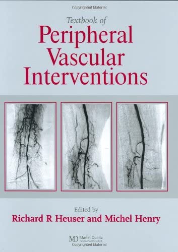 Textbook of Peripheral Vascular Interventions