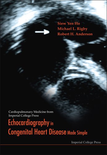 Echocardiography in Congenital Heart Disease Made Simple (Cardiopulmonary Medicine from Imperial College Press) (Cardiopulmonary Medicine from Imperial College Press)