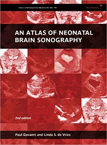 An Atlas of Neonatal Brain Sonography