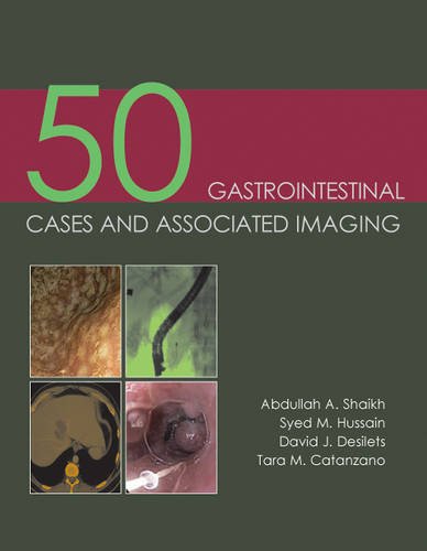 50 Gastrointestinal Cases &amp; Associated Imaging. Abdullah A. Shaikh ... [Et Al.]