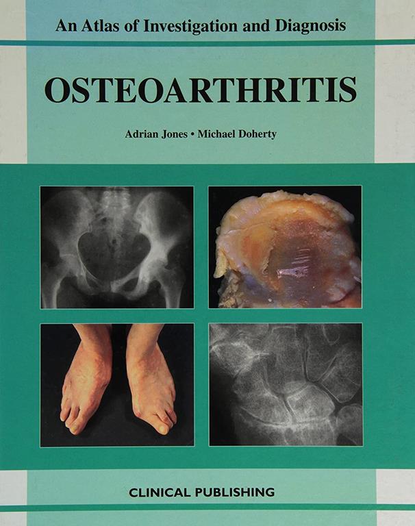 Oesteoarthritis