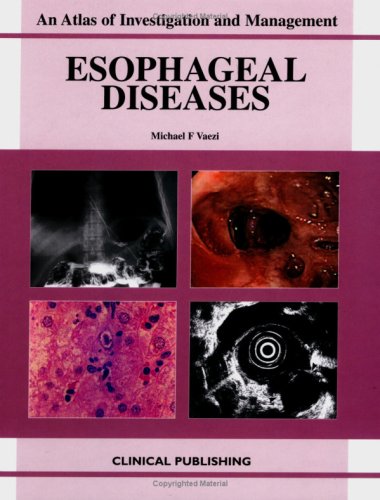 Esophageal Diseases