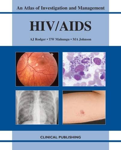 HIV/ AIDS: Atlas of Investigation and Management