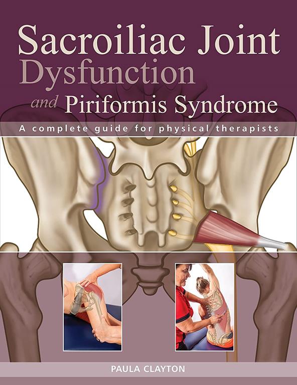 Sacroiliac Joint Dysfunction Piriformis