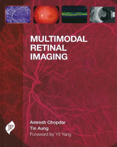 Multimodal Retinal Imaging